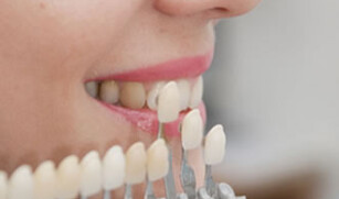 Cosmetic Dentistry